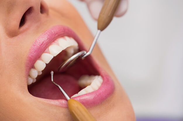 پوسیدگی و عفونت دندان؛ جلوگیری و درمان