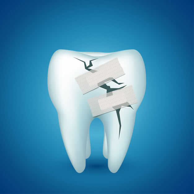 پوسیدگی و عفونت دندان؛ جلوگیری و درمان