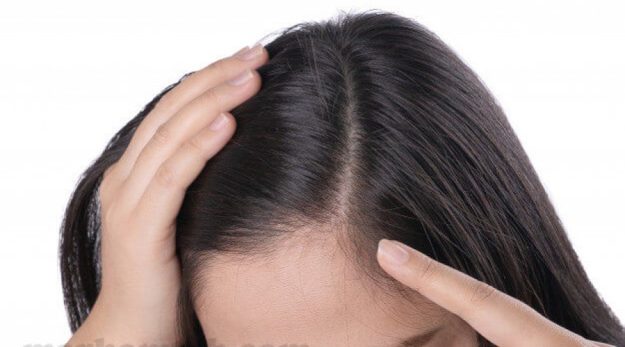 آیا روغن آرگان برای ریزش مو موثر است ؟