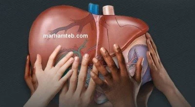 مراقب باشید کبد شما چرب نشود !