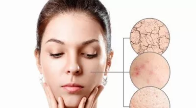 خواص روغن درخت چای از نگاه طب سنتی