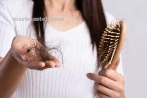 10 روش موثر در درمان ریزش مو