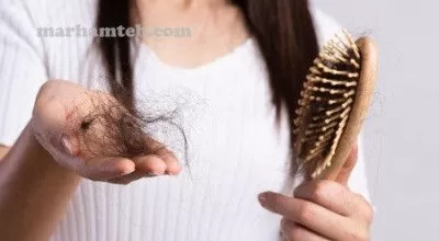 10 روش موثر در درمان ریزش مو