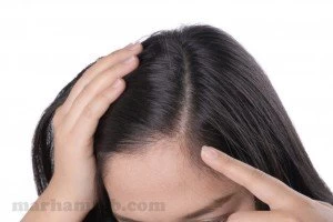 آیا روغن آرگان برای ریزش مو موثر است ؟