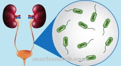 اصلی ترین دلایل ایجاد ادرار دردناک