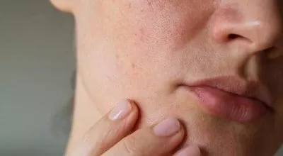 ترفند های ساده برای کاهش منافذ باز پوست