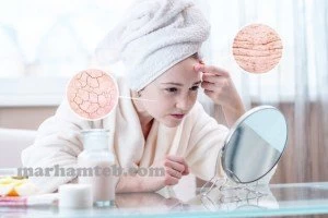 محافظت از پوست در برابر چین و چروک با محصولات طبیعی